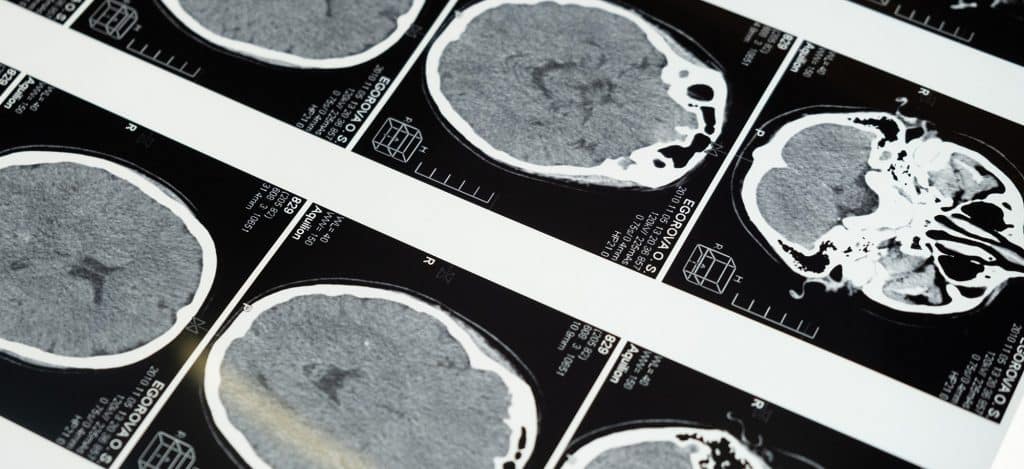 fonctionnement du cerveau